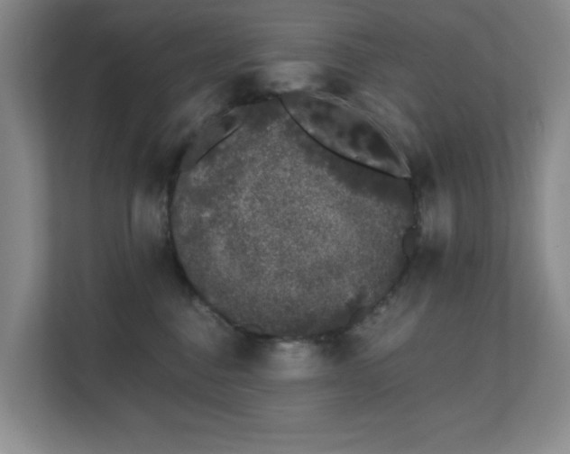 X0000111620376200907171249