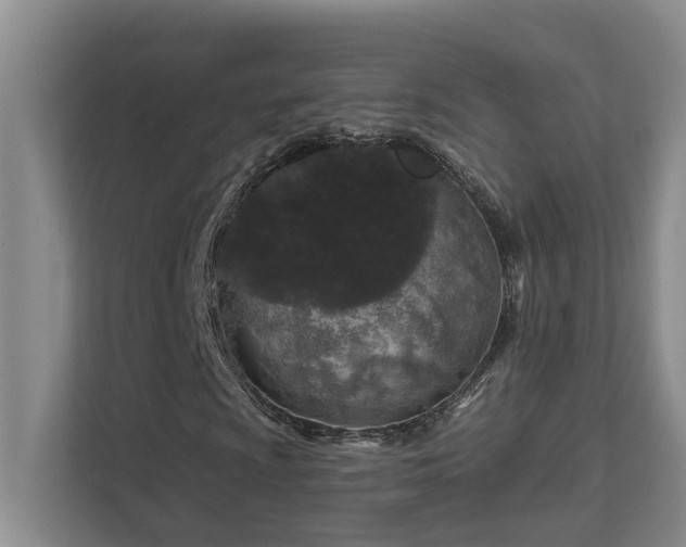 X0000111621009200907171240