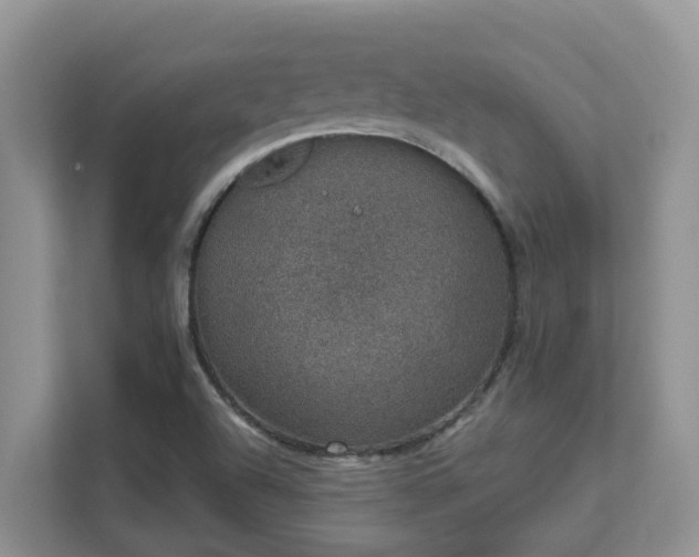 X0000111621504200907171233