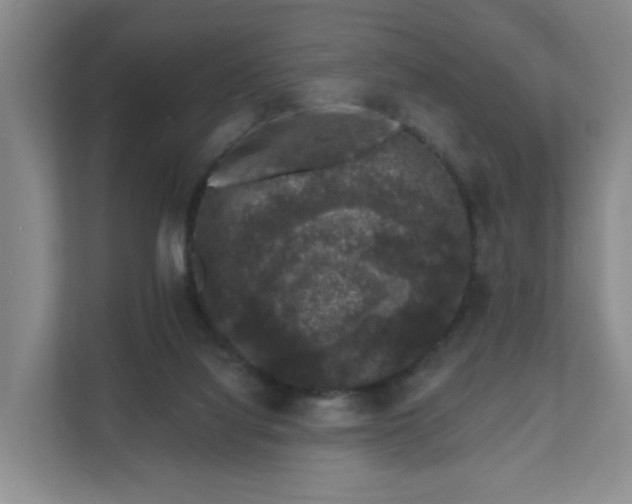 X0000111620068200907241038