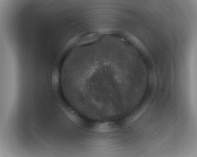 X0000111620072200907241038