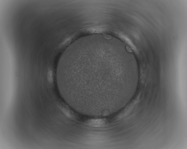 X0000111620161200907241037