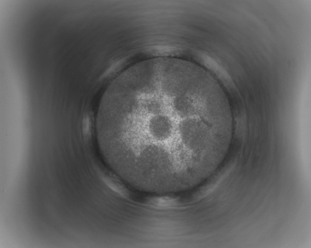X0000111620165200907241037
