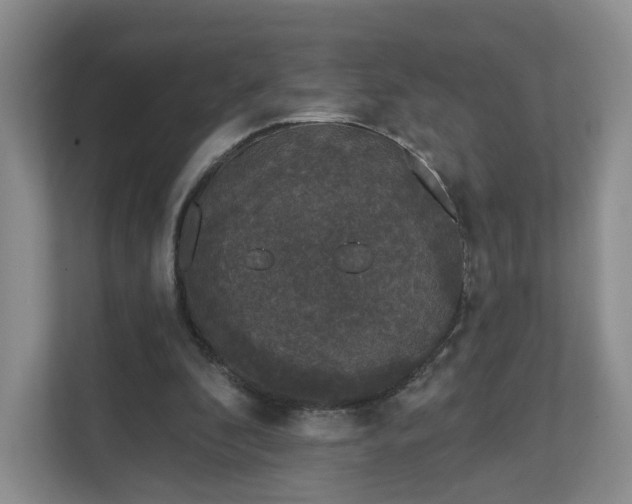 X0000111620296200907241035