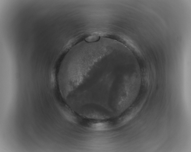 X0000111620312200907241035