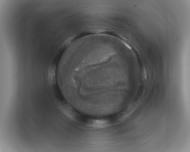 X0000111620360200907241035