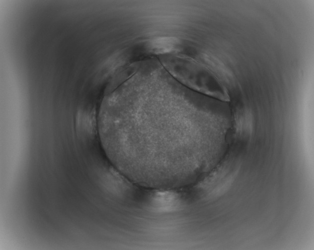 X0000111620376200907241035