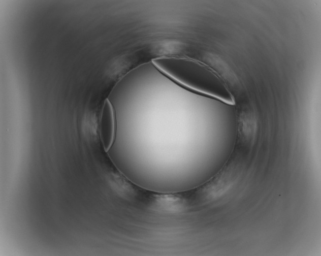X0000111620380200907241035