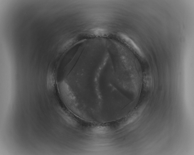 X0000111620593200907241032