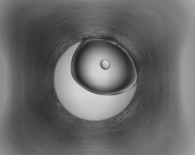 X0000111621060200907241025