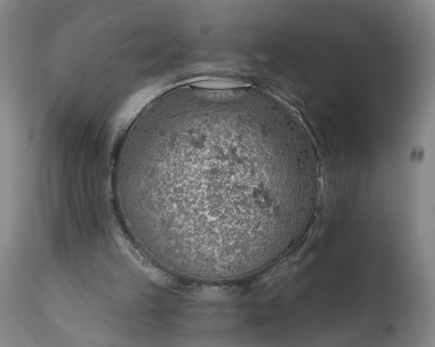 X0000111620149200907311211