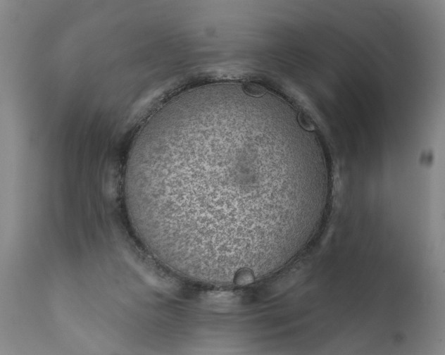 X0000111620161200907311211