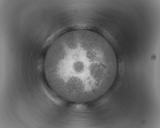 X0000111620165200907311211