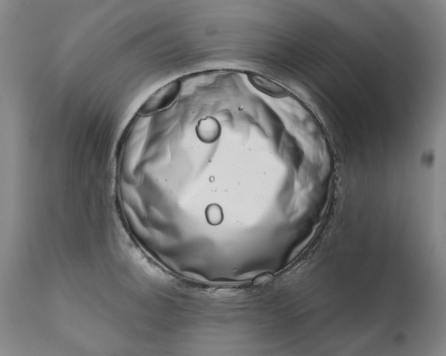 X0000111621140200907311156