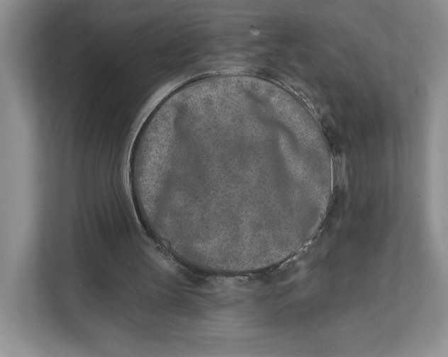 X0000111620147200908071357