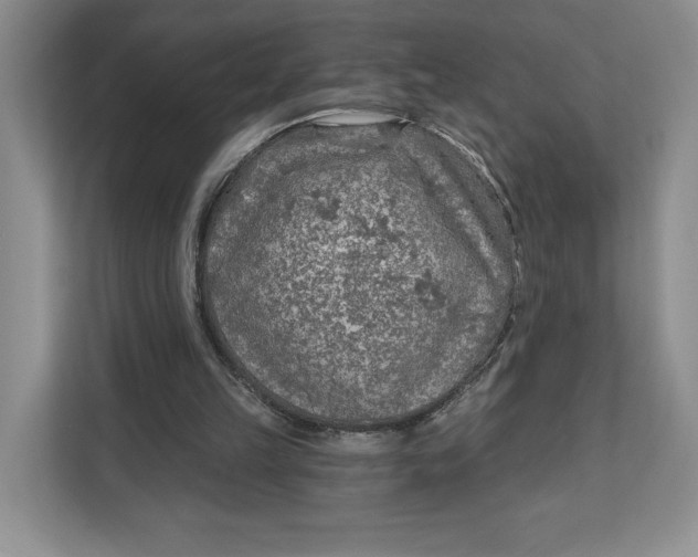 X0000111620149200908071357