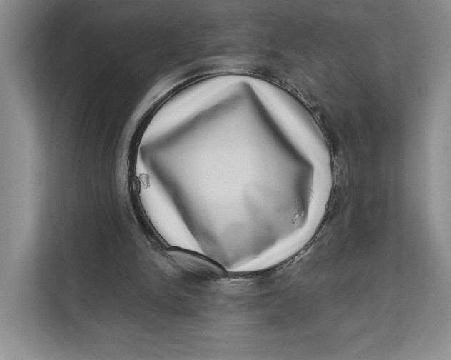 X0000111620150200908071357