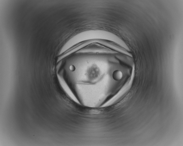 X0000111620176200908071358