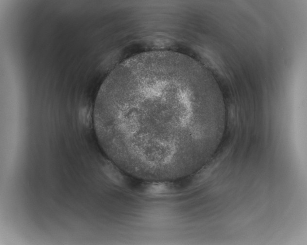 X0000111620177200908071358