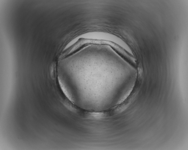 X0000111620233200908071357