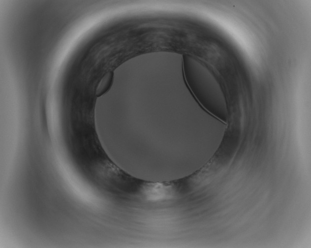 X0000111620239200908071357