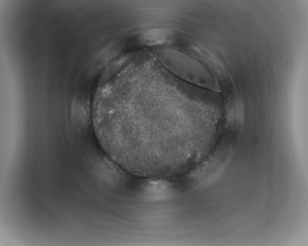 X0000111620376200908071355