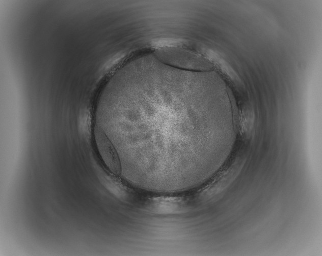 X0000111620448200908071354