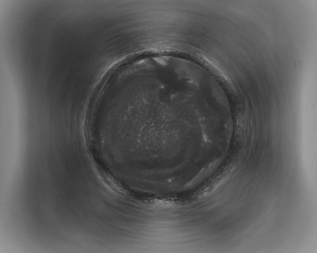 X0000111620592200908071352