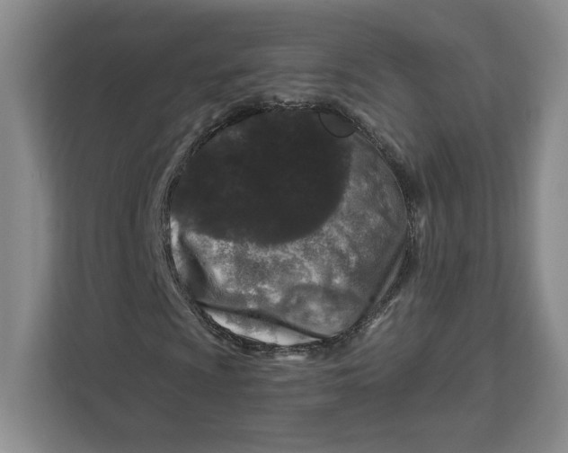 X0000111621009200908071346