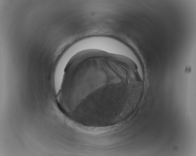 X0000111620019200908141329