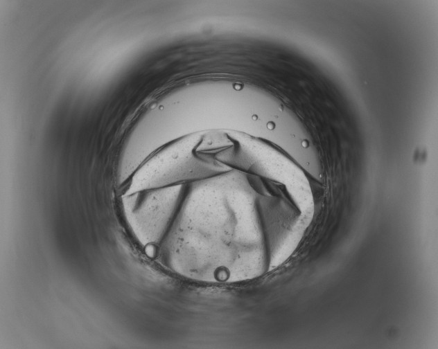 X0000111620146200908141327