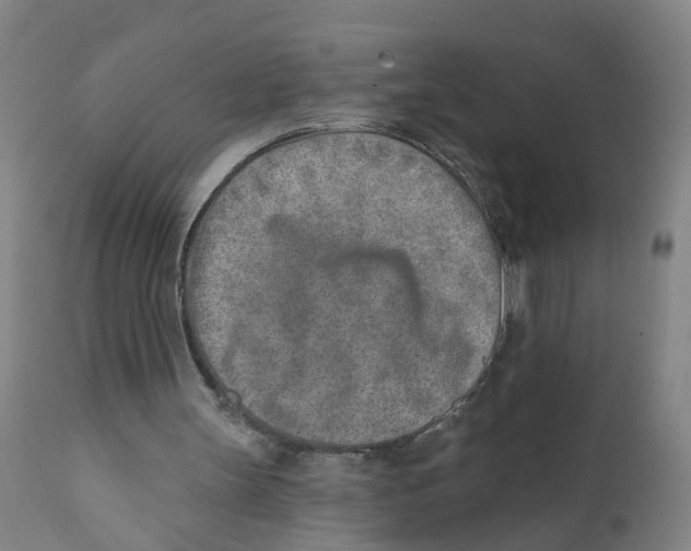 X0000111620147200908141327