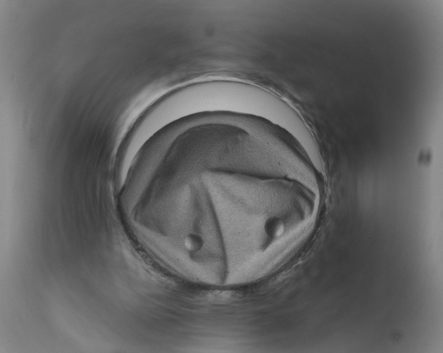 X0000111620152200908141327