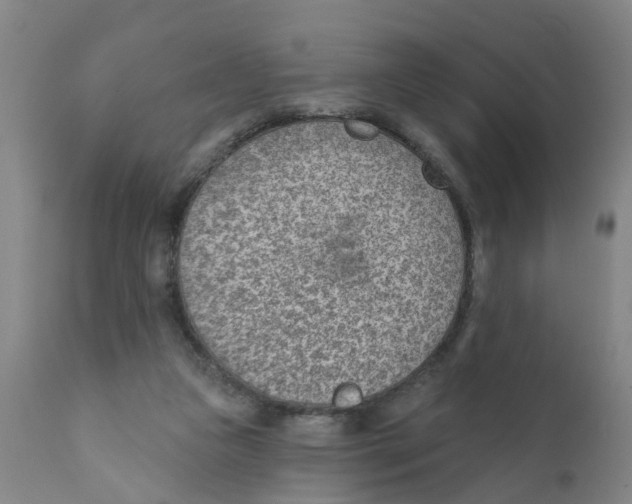 X0000111620161200908141327