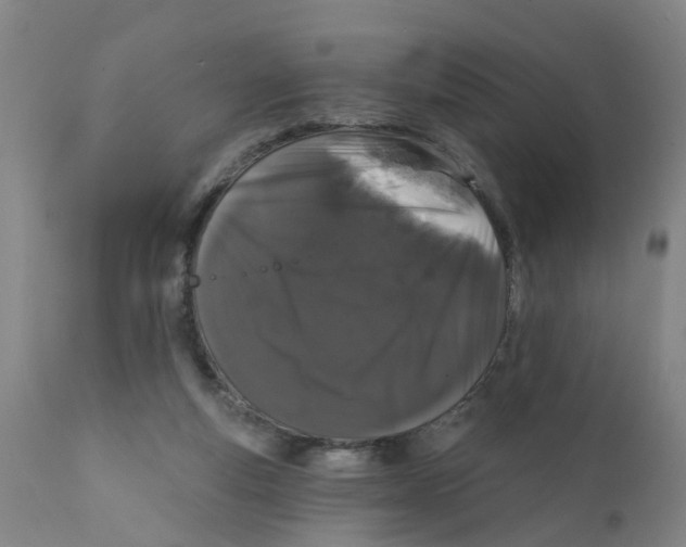 X0000111620163200908141327