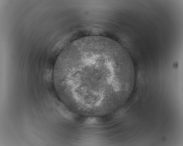 X0000111620177200908141327