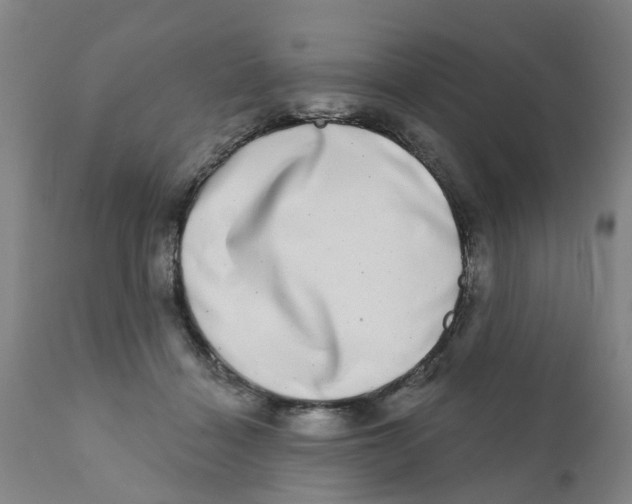 X0000111620460200908141322