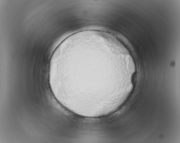 X0000111620860200908141316