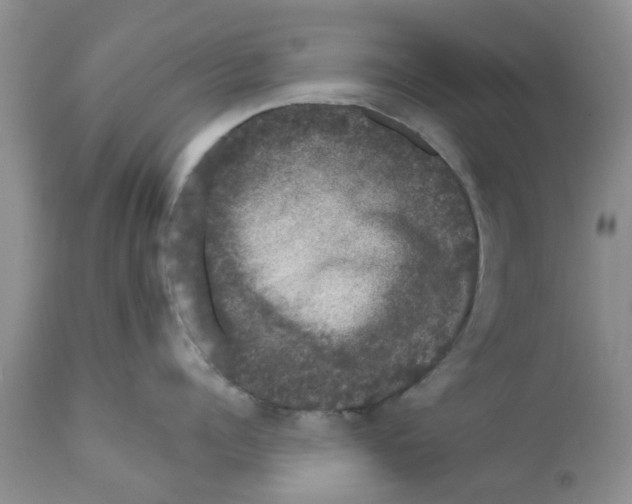 X0000111620960200908141315