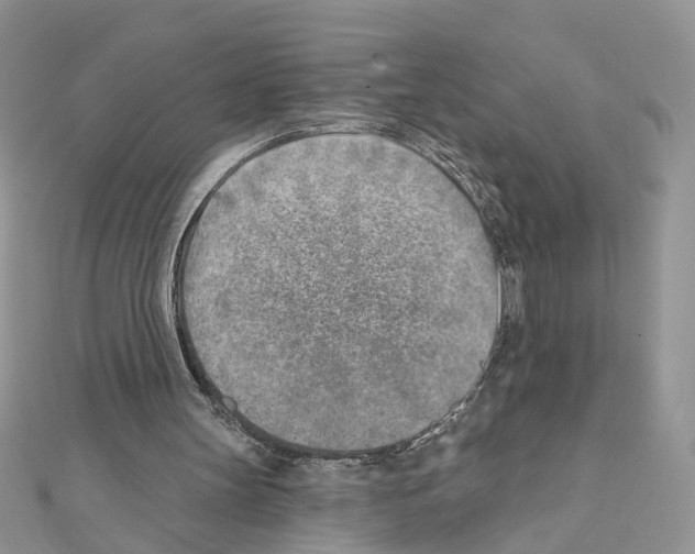 X0000111620147200908281120