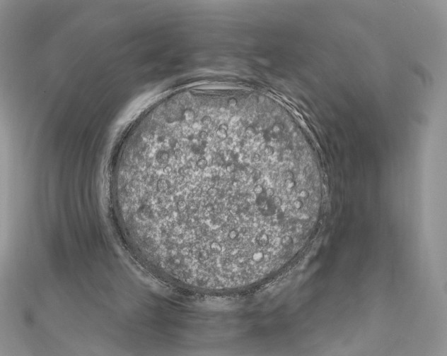 X0000111620149200908281120