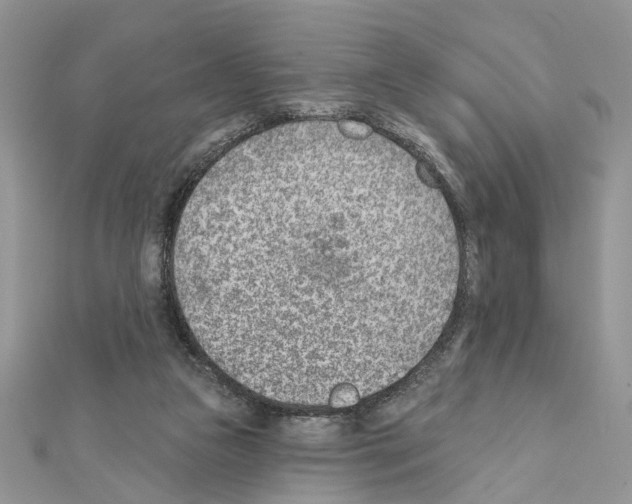 X0000111620161200908281120