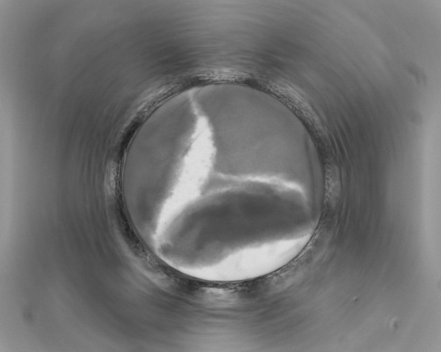 X0000111620167200908281120