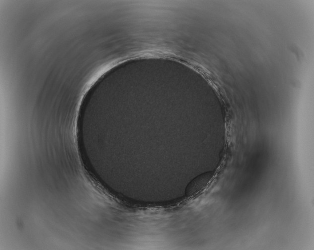 X0000111620196200908281120