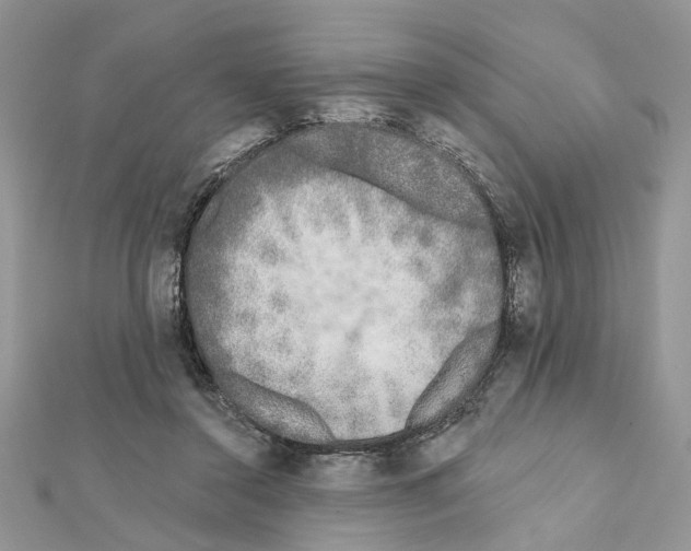 X0000111620356200908281118