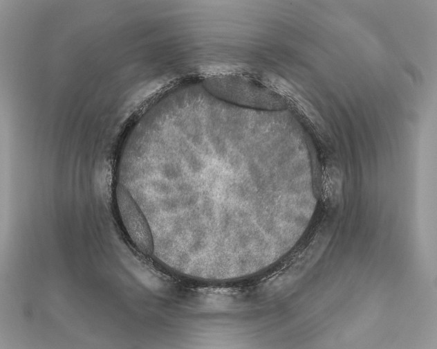 X0000111620448200908281116