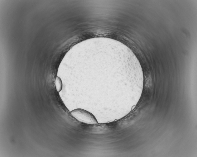 X0000111620666200908281114