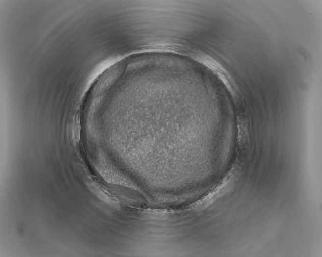 X0000111621069200908281108