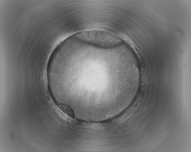 X0000111621072200908281108