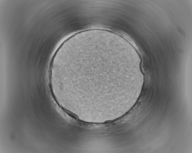 X0000111621148200908281107